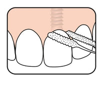 Load image into Gallery viewer, TePe Bridge and Implant Floss ™ 30's