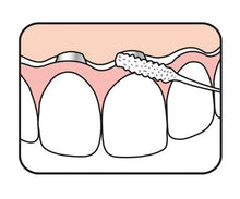 Load image into Gallery viewer, TePe Bridge and Implant Floss ™ 30&#39;s
