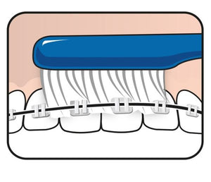 TePe Implant Orthodontic™